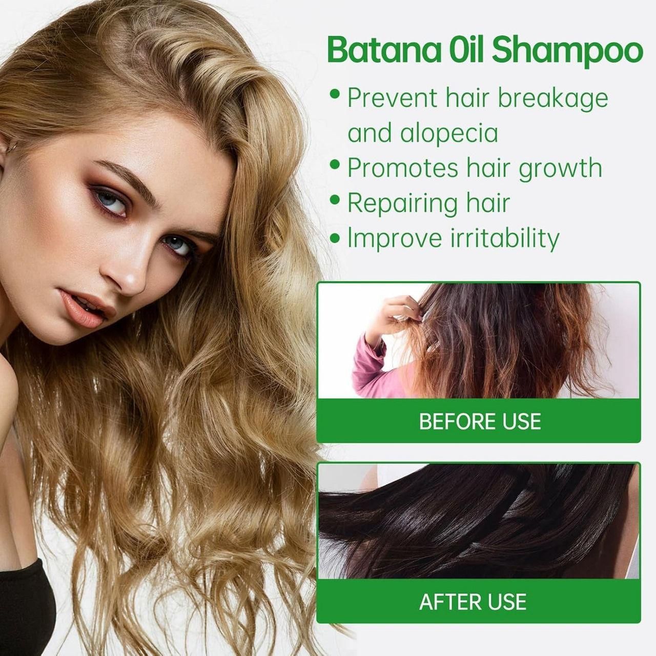 BATANA OIL SHAMPOO with Rosemary Extract 400 ml Pack of 2