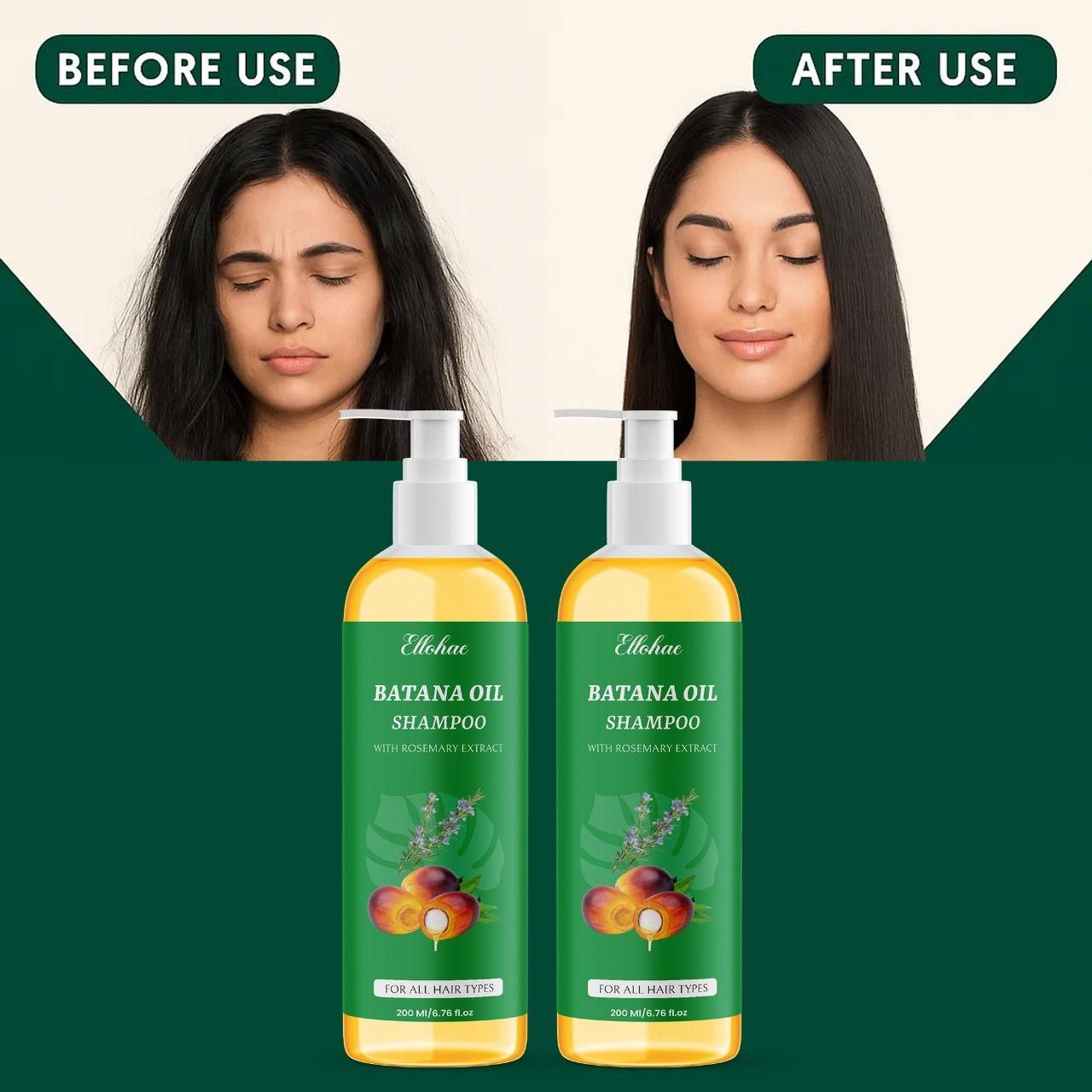 BATANA OIL SHAMPOO with Rosemary Extract 400 ml Pack of 2
